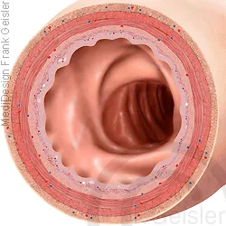 Lumen Dickdarm Colon